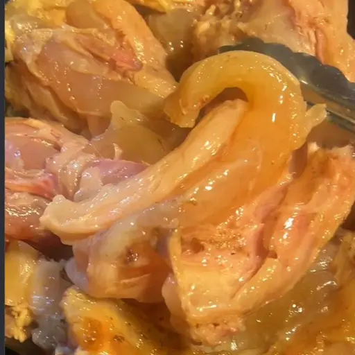 صحن عصب — Tendon Plate